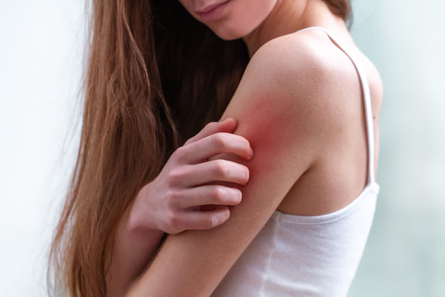 young-woman-suffering-from-itching-her-skin-scratching-itchy-place