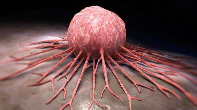 kanser-hucresi-vucutta-nasil-beslenir